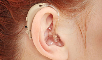A 0517 BTE hearing-aid bntbxg A